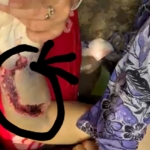 Diduga Kelalaian Medis, Dirut RSUD Rantauprapat Bungkam Saat Dikonfirmasi!