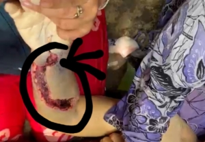 Klarivilasi RSUD Rantaprapat  terkait Alm Kasmawati Siregar yang kurang mendapat pelayanan.